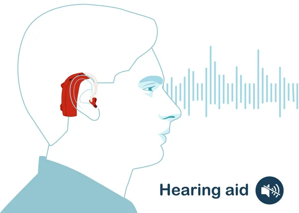 補聴器を耳に装着してください 聴覚障害者と聴覚障害者のための 音波付き フラットスタイルの現代的なベクトルイラスト — ストックベクタ