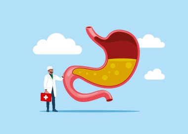 Doktorun elinde büyük bir işaret var. Mide asidi dolu insan midesi. Kesik görüş. Gastroözofagus reflü hastalığı. Vektör illüstrasyonu. 