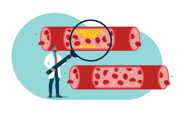 Médecin Étudiant Les Vaisseaux Sanguins Les Veines Cholestérol Caillot Cellules — Image vectorielle