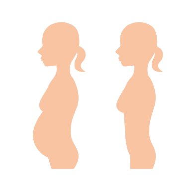İllüstrasyon öncesi ve sonrası obezite