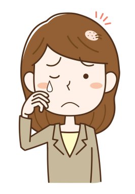 Alopecia areata 'dan muzdarip bir kadın.