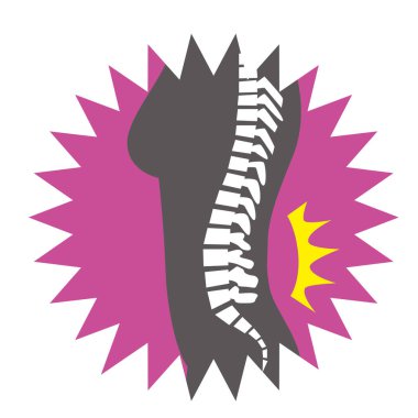 Sırtı ağrıyan bir kadının resmi