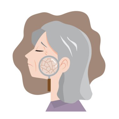 Kuru ciltten muzdarip yaşlı kadın.