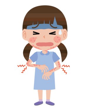 Atopik deri iltihabı olan bir kız.