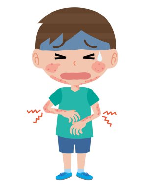 Çocuk atopik dermatitten muzdarip.