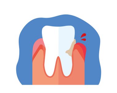 Şişmiş ve kanayan diş etleri.