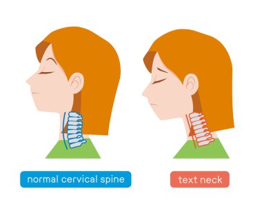 Servikal omurga ve boyun röntgeni.