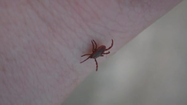 Parasite Dangereux Tique Dure Tique Échelle Ixodes Rampe Sur Peau — Video