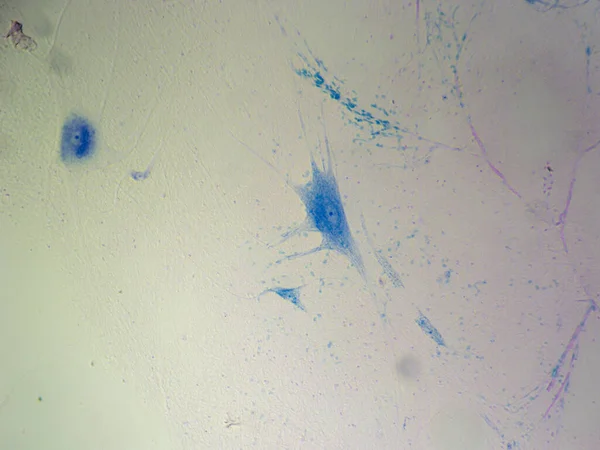 Δομικά Στοιχεία Του Εγκεφάλου Ενιαία Neuron Στην Εκπληκτική Μπλε Stain — Φωτογραφία Αρχείου