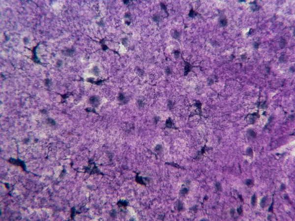 Astrocyty Hvězdami Tvarované Buňky Mozku Vysokém Zvětšení — Stock fotografie