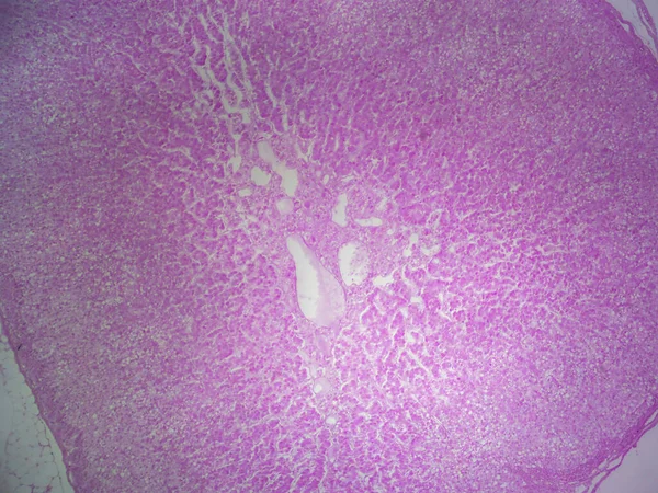 肾上腺的内部 细观中的Cortex和Mąla — 图库照片