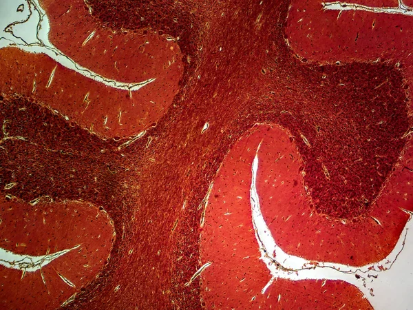 Centrum Równowagi Mózgu Móżdżek Srebrnej Kurtce Pod Mikroskopem — Zdjęcie stockowe