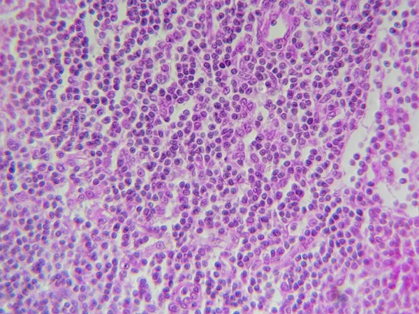 Lmph Node Histology Image View High Detail — 스톡 사진