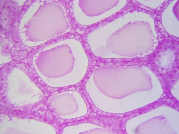 Анатомія Щитовидної Залози Гістологічне Зображення Високих Деталях — стокове фото