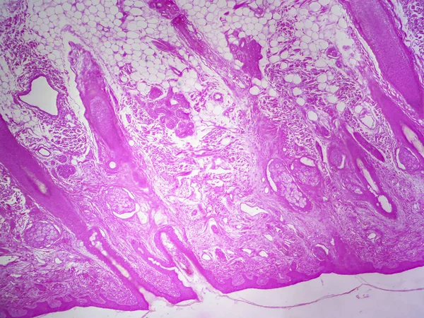 Folículo Cabelo Suas Glândulas Vista Detalhada Sob Microscópio — Fotografia de Stock