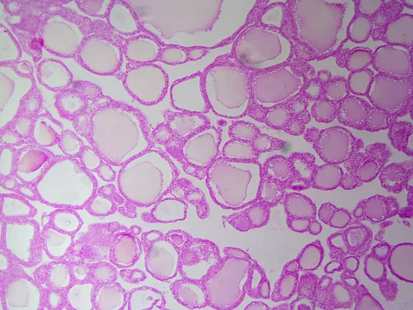 Anatomy Thyroid Histology Image Ohromující Detail — Stock fotografie