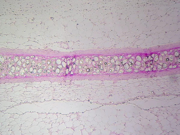 軟骨の美しさ 顕微鏡下で詳しく見るヒアリン軟骨 — ストック写真