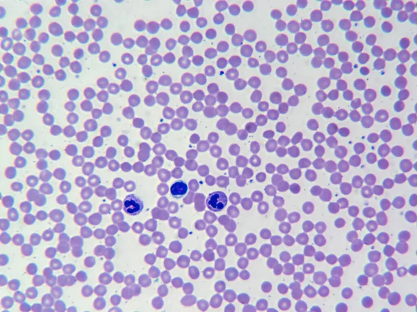 顕微鏡下でのライトの汚れ中の赤と白の血液細胞の見事な詳細 — ストック写真