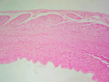 Anatomi Araştırması: Mesanenin Şişmiş Bölümü 100 kat