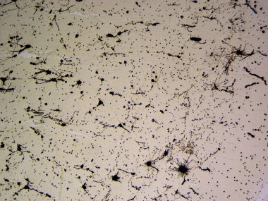 Beyin Güzelliği: Golgi-Lekeli Beyin Korteksi 100 x