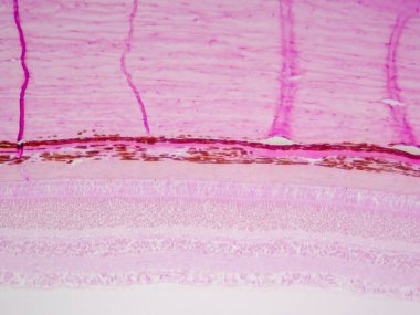 Görünmeyen Güzellik: Retina ve Göz Duvarının Ayrıntılı Katmanları 100 kat