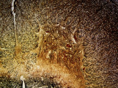 Sinirsel Ağ: Gümüş Lekeli Omurga Dorsal Boynuzu 100 x