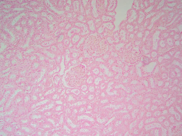 Renal Anatomy Closeup Kidney Cortex Tubules Glomeruli 100X — Stok Foto