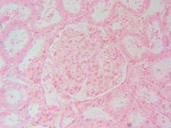 Nierenstern Einzelne Glomerulus Nahaufnahme Bei 400X — Stockfoto