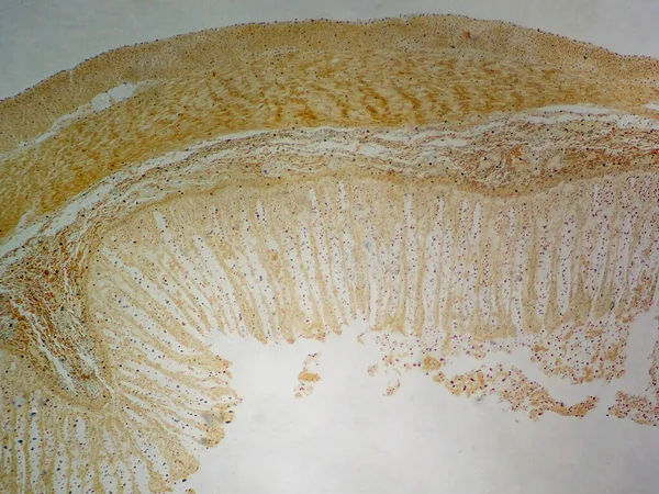 腸深さ 40Xで発見された小さな腸層 — ストック写真