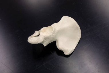 Anatomik sol kalça kemiği modeli, leğen kemiği eğriliği ve asetabüler yönelimi gösteren üst açıyla siyah bir laboratuvar yüzeyinde fotoğraflanmış..
