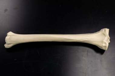 Sağ kaval kemiğinin anatomik modelinin tam yanal görüntüsü siyah arkaplanda hem proksimal hem de distal uçlarını gösteriyor.