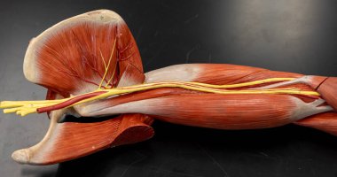 Subscapularis kası ve köprücük kemiğinin altından ve omuz ekleminin etrafından gelen brakiyal pleksus sinirlerinin ön plana çıkarılması.