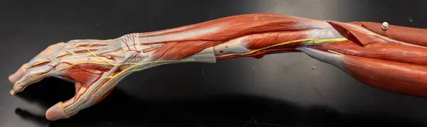 Anatomik model ön kolun yan kompartımanında brachioradialis ve genişletici karpi radialis longus ile seyahat eden radyal siniri gösteriyor.