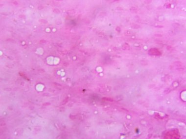 Domuz adipoz dokusunun yüksek büyütme (400x) görüntüsü yerlerinden edilmiş çekirdekleri ve büyük lipit depolama alanları ile adyositlerin bal peteğine benzeyen görünümünü gösteriyor.