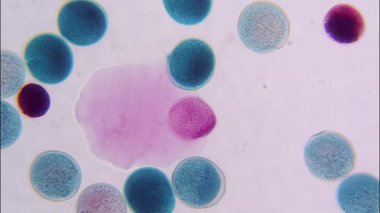 Polen Patty 'nin 400x büyütülmüş tüm dağının mikroskop videosu