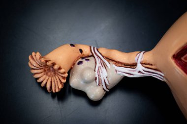 Jinekolojik anatomi ve tıp bilimi eğitimi için kullanılan kistleri, endometriyozu ve adhezyonları gösteren bir rahim modeli..