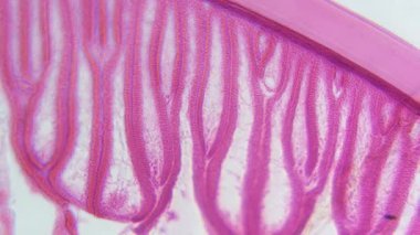 Dişi bir Ascaris yuvarlak kurtçuğu kesitinde 400x üst deri ve kas katmanlarında yakınlaştırılmış görüntü. Tırnak derisi, deri altı ve boylamsal kas hücrelerinin histolojik detayları görülebilir..