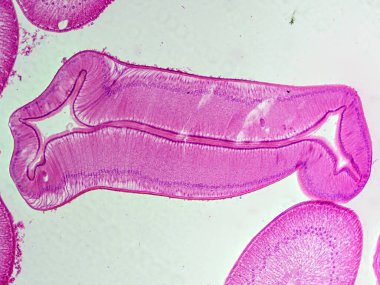 Dişi bir Ascaris yuvarlak solucanının bağırsak bölgesinin mikroskobik kesiti 100 kat büyütülmüş bağırsak epitelyumu ve lümen yapısını gösteriyor..