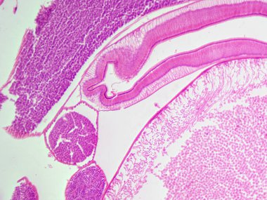Mikroskobik kesit, erkek bir Ascaris yuvarlak solucanının 100 kat büyütülmüş hali. Testisleri, bağırsak dokusunu ve vaz geçişini gösteriyor..