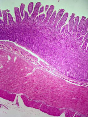 Memeli uterus tüpünün 40x 'teki düşük büyütme mikroskobu görüntüsü üreme fonksiyonu için lümeni saran sütun epitelyumu gösteriyor..