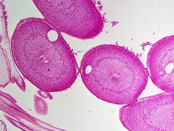 Dişi bir Ascaris yuvarlak solucanındaki mikroskop görüntüsü 100 kat büyütülmüş, ositleri ve üreme yapılarını gösteriyor..