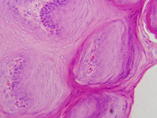 Memeli dilinin 400x büyültülmüş epitelyumunun yakın çekimli bir bölümü, katmanlı skuamöz epitel hücreleri gösteriyor..