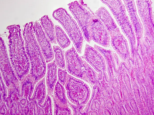 100 x 'te bir köpekten alınan mikroskobik rahim tüpü dokusu, kolon epitel hücrelerini ve lümen yapısını gösteriyor..