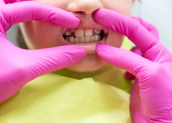 stock image Dentist examining child's teeth up close. High quality photo