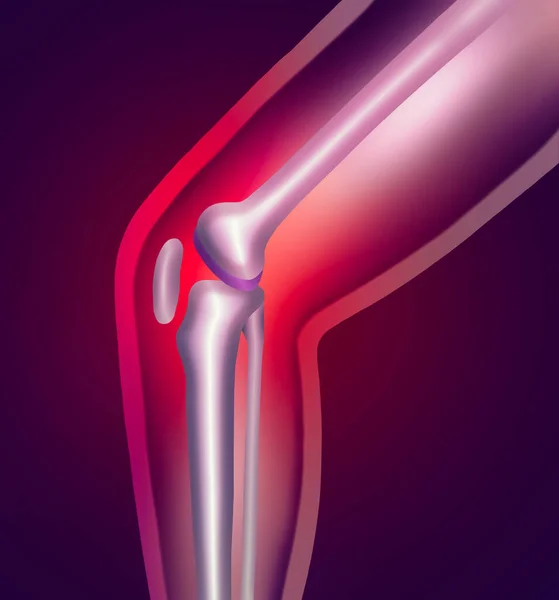 Joint pain, knee pain icon with red circle marker illustration