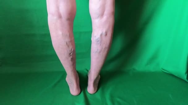 女性の上の静脈上のシニア脚を閉じる — ストック動画
