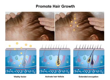 Hair growth phase, anatomy diagram of human hair. AD for essential oil or serum for hair growth clipart