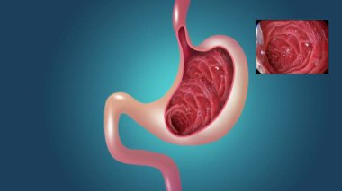 2 boyutlu animasyon. Mide mukozası. Sindirim endoskopisi ya da gastroskopi. Mide sağlığı. Tıbbi konsept. İnsan vücudu anatomisi mide animasyonu