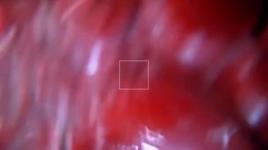 Gastroscopy examination of the gullet and stomach