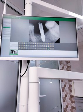 Tanı ve tedavi planlaması için çene ve dişlerin eksensel, koronal, sagittal ve 3B görüntülerini gösteren detaylı diş tomografisi.